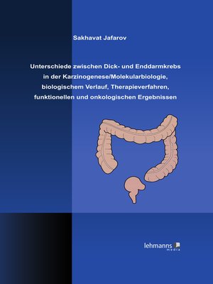 cover image of Unterschiede zwischen Dick- und Enddarmkrebs in der Karzinogenese/Molekularbiologie, biologischem Verlauf, Therapieverfahren, funktionellen und onkologischen Ergebnissen